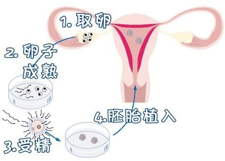 代孕一站式服务